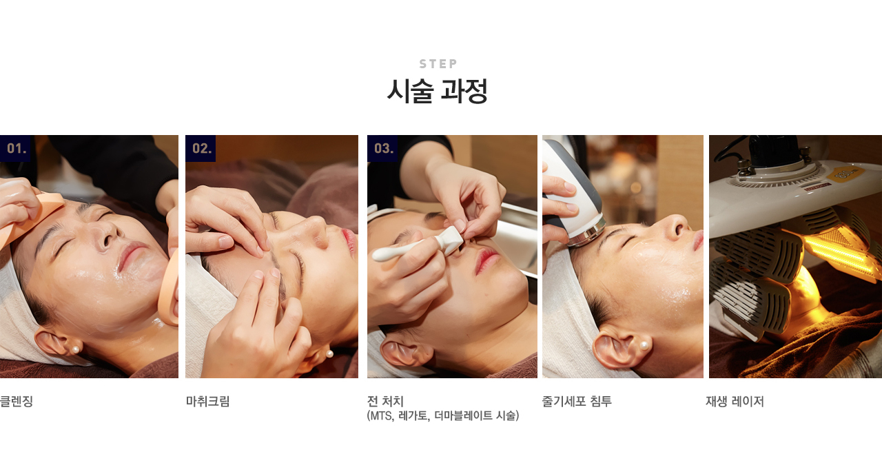 줄기세포 피부재생 프로그램
