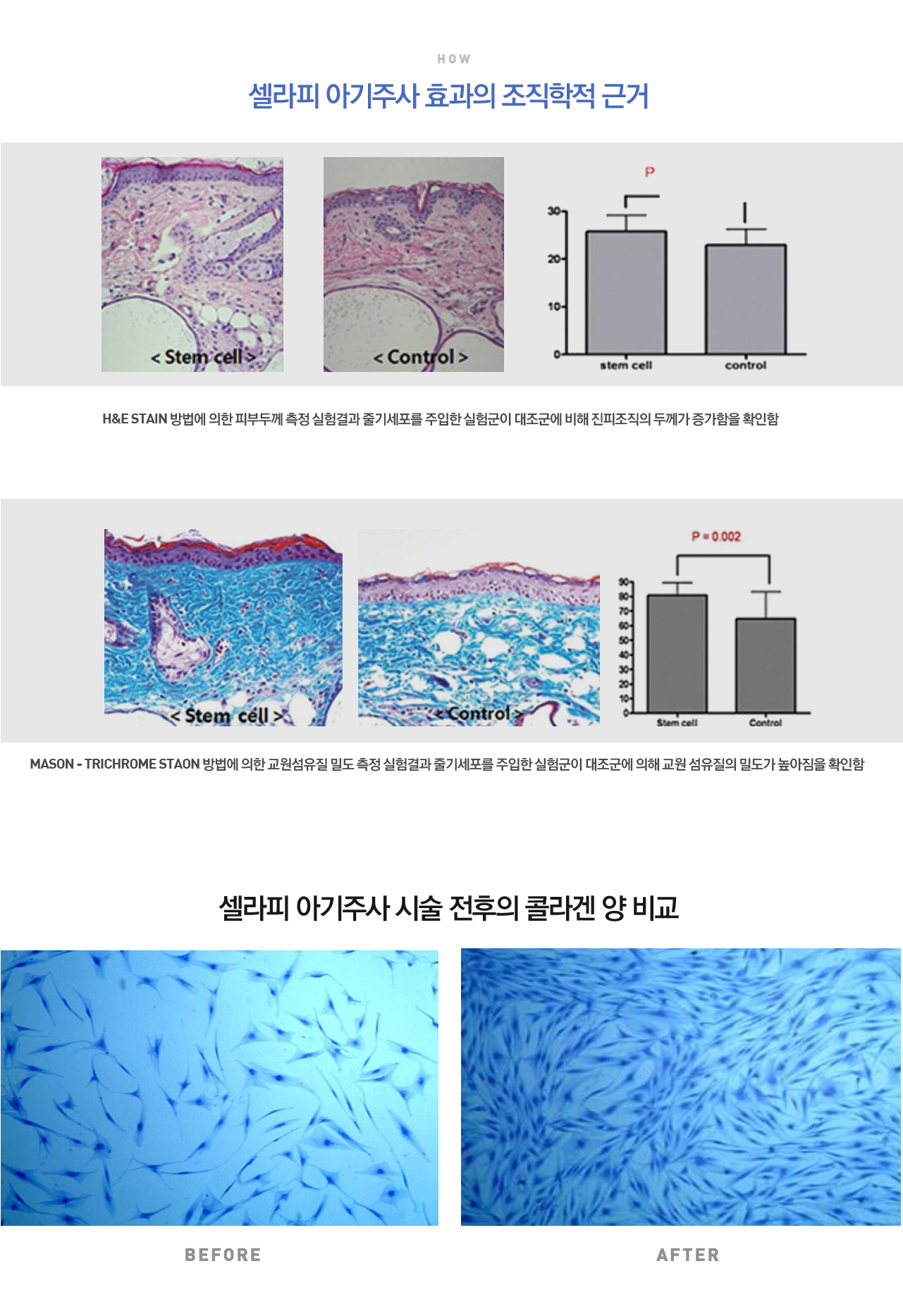 줄기세포 피부재생 프로그램