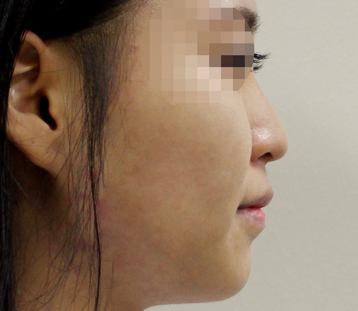미쥬코  Before