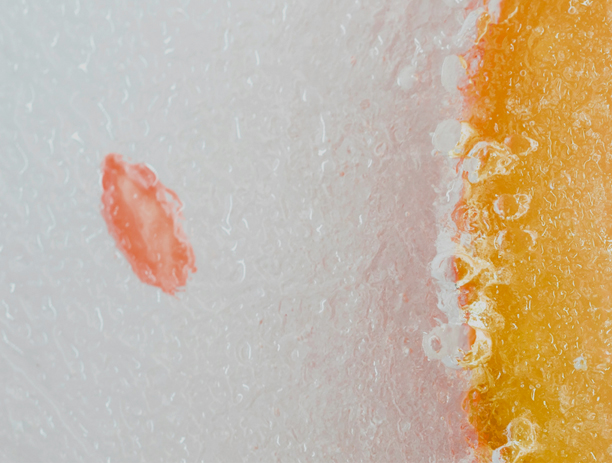 세인트클리닉 색소클리닉