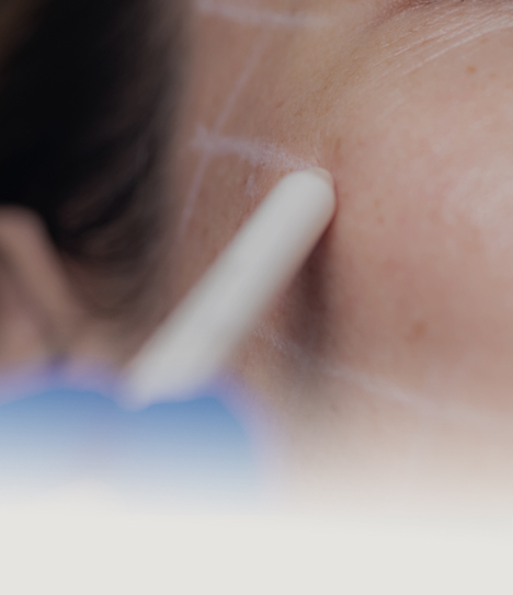 커스텀 리프팅 프로그램