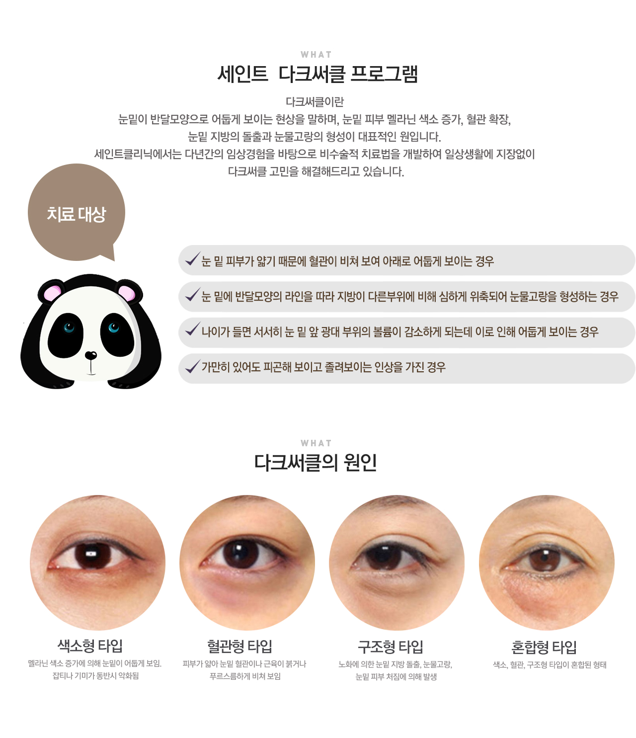 다크써클 고민