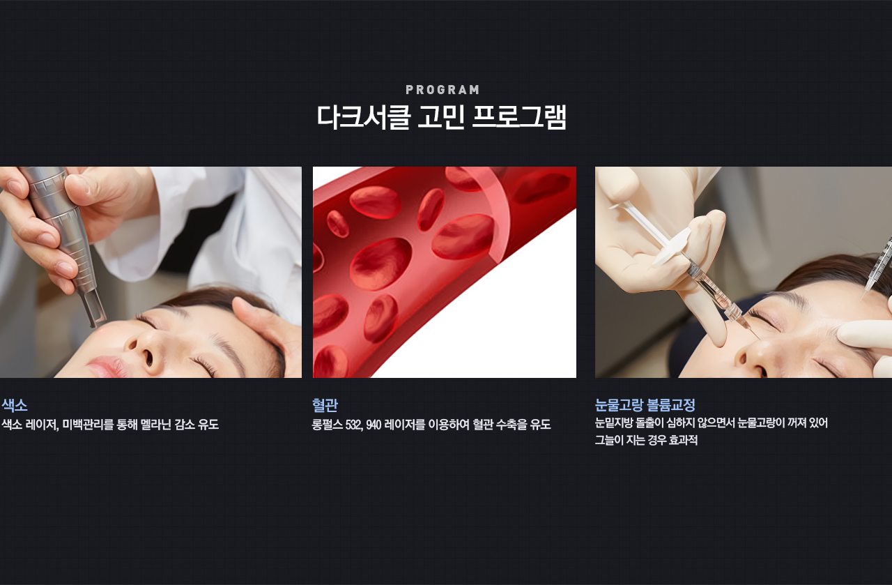 다크써클 고민