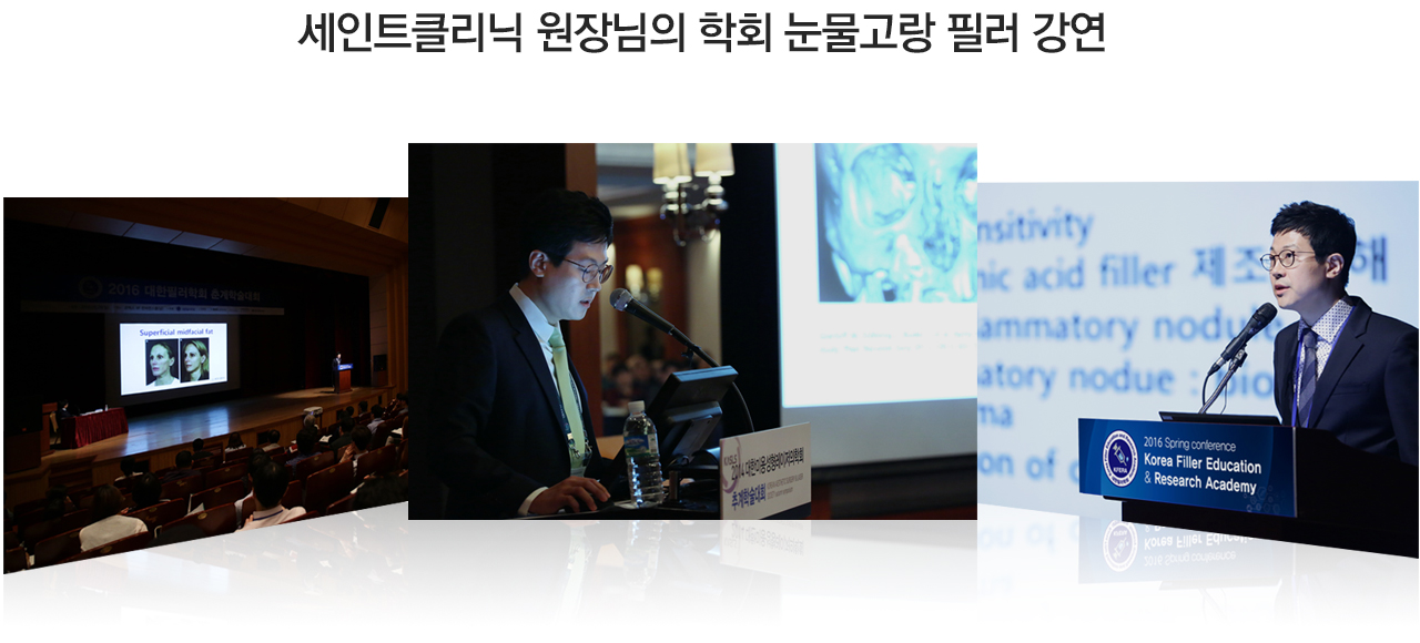 다크써클 고민