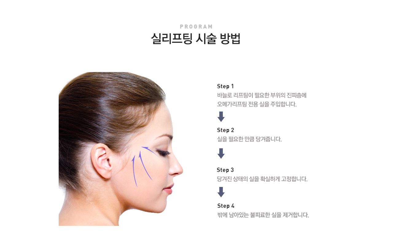 실리프팅