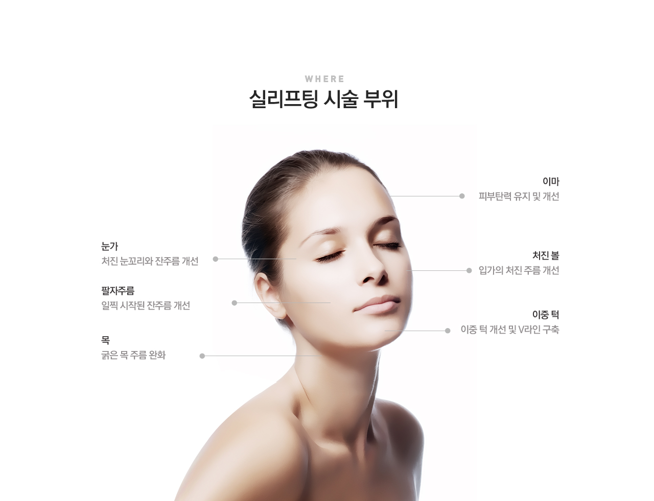 실리프팅