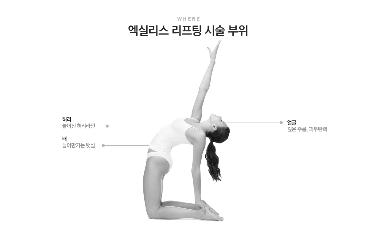 엑실리스 리프팅