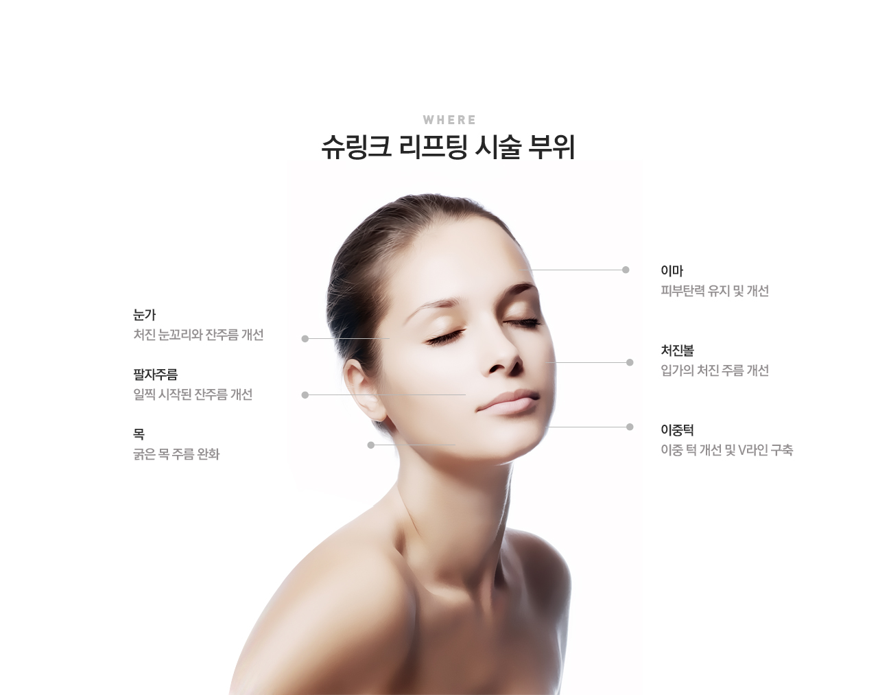 슈링크 리프팅