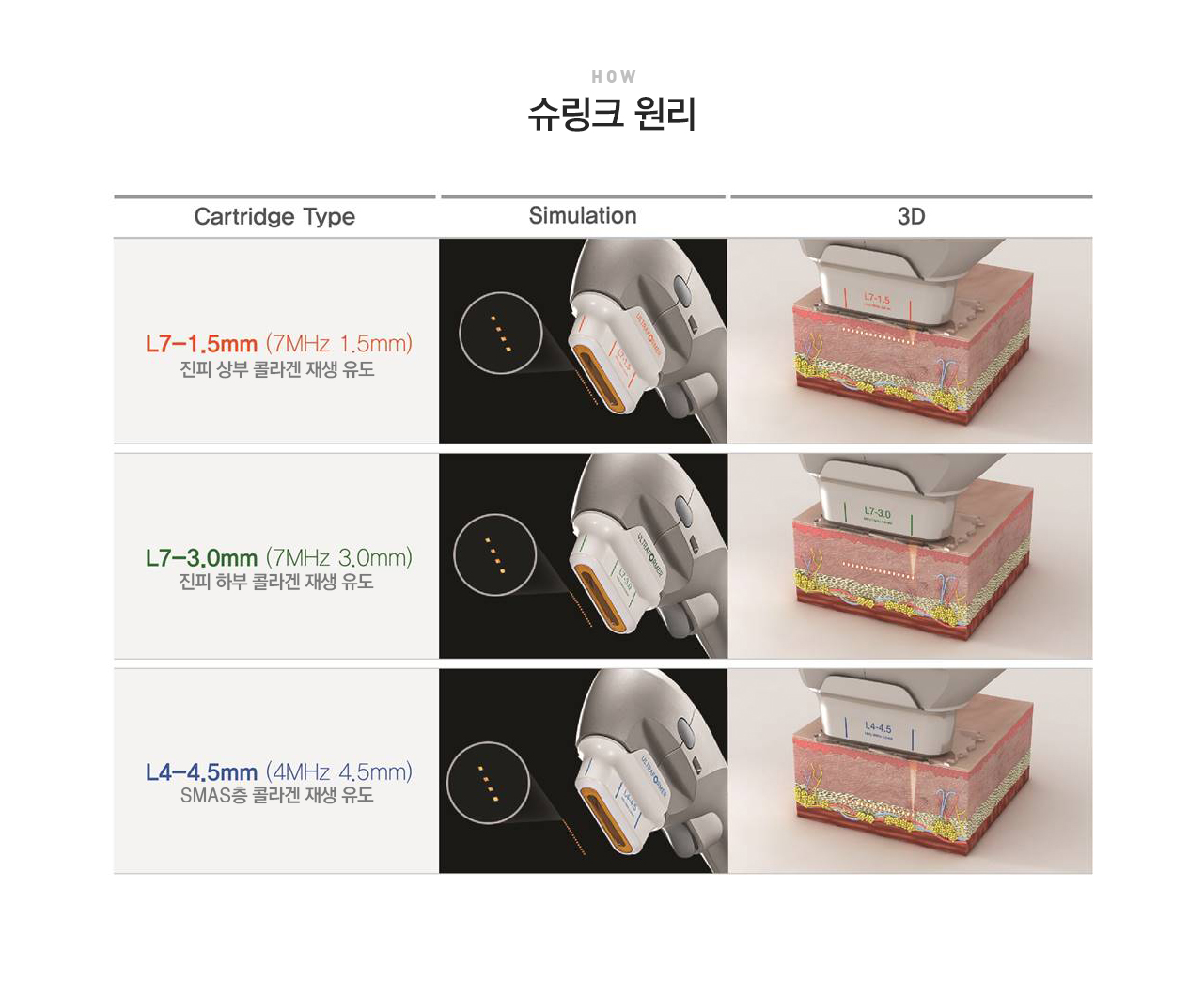 슈링크 리프팅