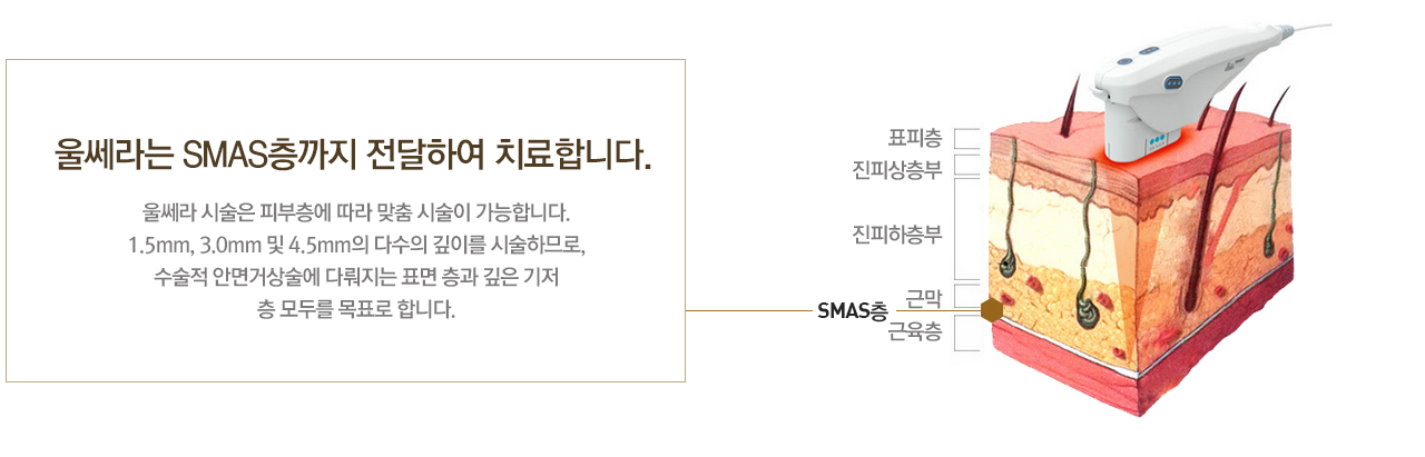 울쎄라