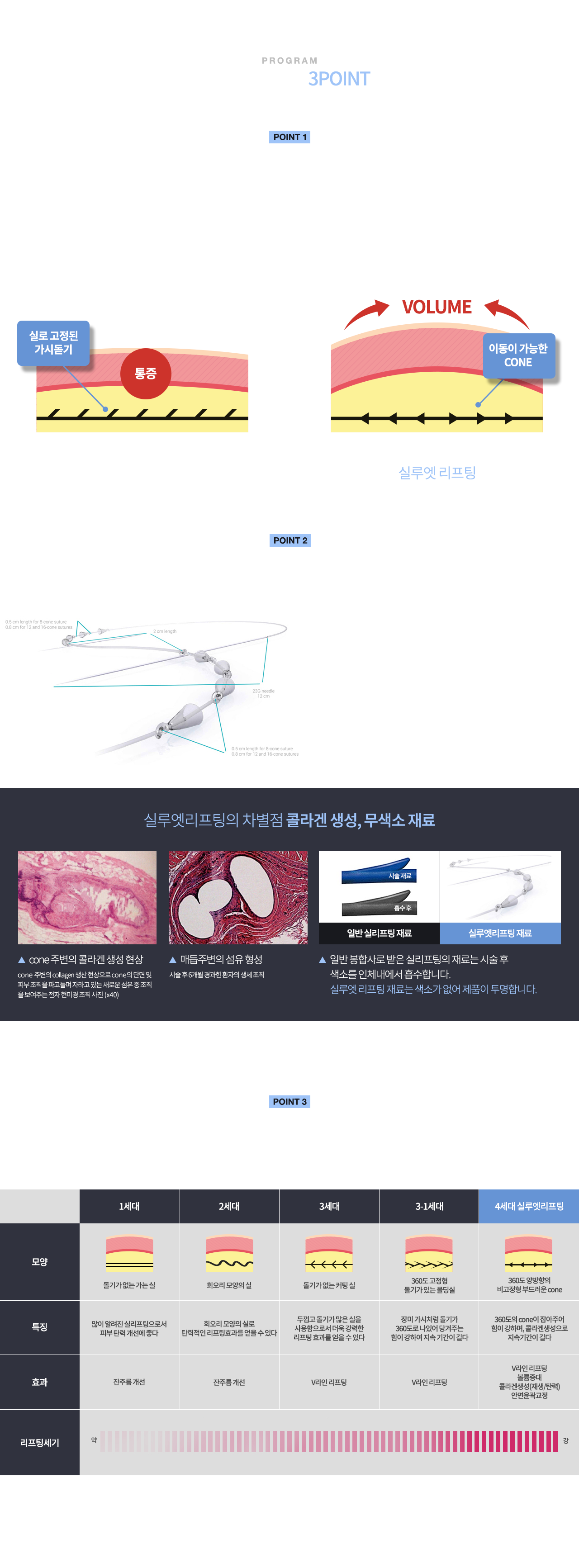 실루엣리프팅