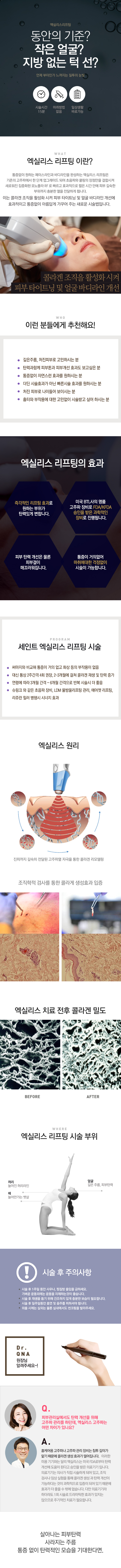 엑실리스 리프팅