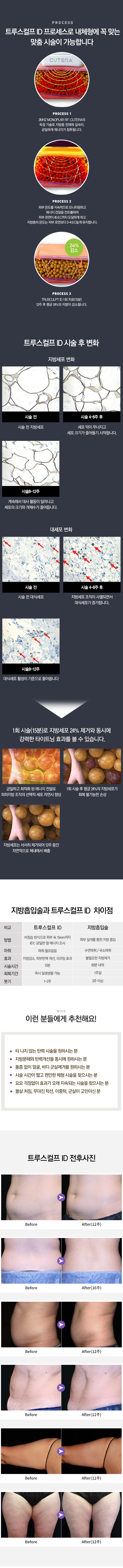 트루스컬프 ID